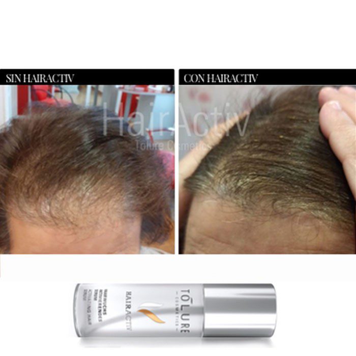 Tolure HairActiv 100 ml