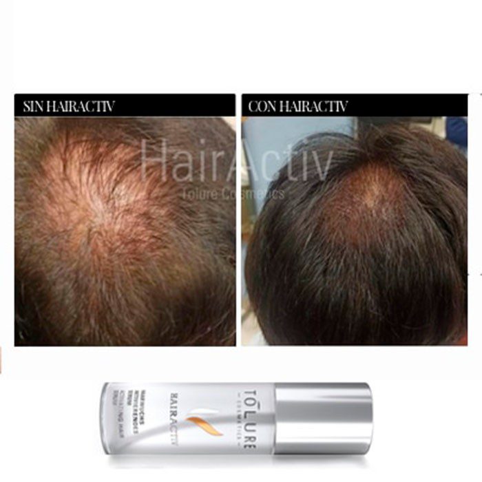 Tolure HairActiv 100 ml - Prof