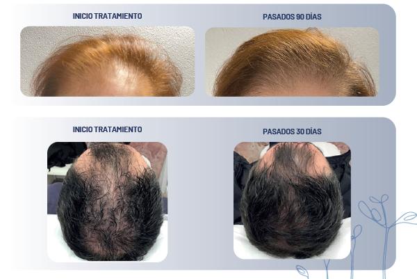 Kit Growth Capilar Hissys Technologies